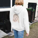 Albinos